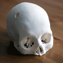 Cerebrix Human Skull post surgery